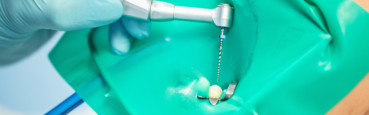 治療する歯のみ隔離したラバーダム感染ルートを徹底的に断ち、無菌環境での治療